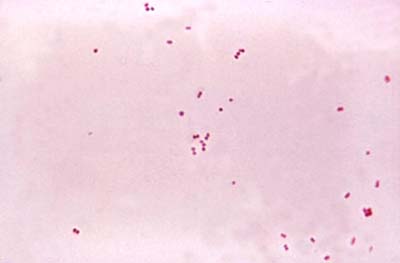  A bactéria <EM>Neisseria meningitidis</EM> (meningococo). Foto: Centers for Disease Control (CCD) 